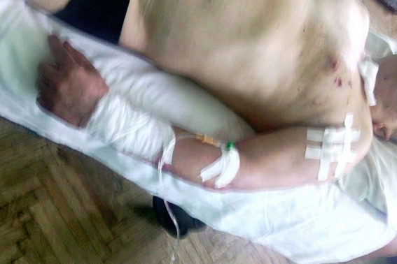 Поліція Прикарпаття розслідує замах на вбивство чиновника (ФОТО)