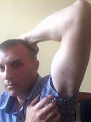 Чайковський просить суд стягнути з головного патрульного Франківська 128 тисяч моральної шкоди