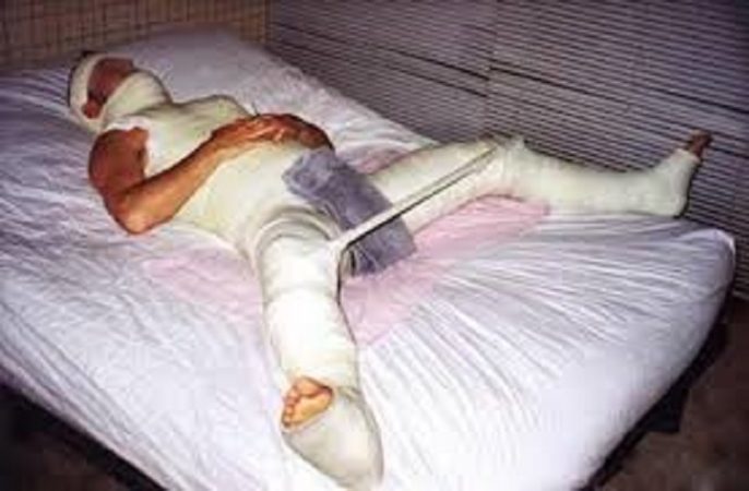 Хотів зґвалтувати собаку, і залишився без “знаряддя ґвалтування” (ФОТО)