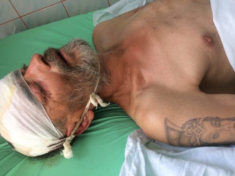 Поліція просить впізнати чоловіка, котрий з травмами лежить у комі (ФОТО)