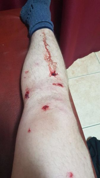 У Чернівцях за два дні побили двох активістів-антикорупціонерів (ФОТО)
