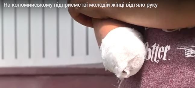 На Прикарпатті жінка вимагає компенсацію за те, що на підприємстві їй відтяло руку (ВІДЕО)