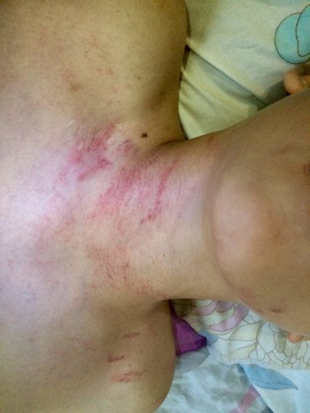 Франківського активіста звинувачують у побитті хлопчика з інвалідністю (ФОТО)