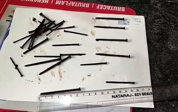 В Індії чоловік проковтнув 116 цвяхів і провід