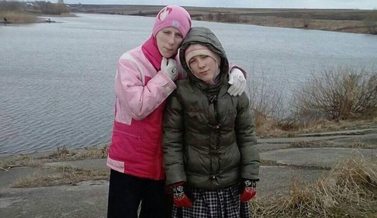 У сім’ї з Прикарпаття народилися дві доньки з рідкісною патологією (ФОТО)