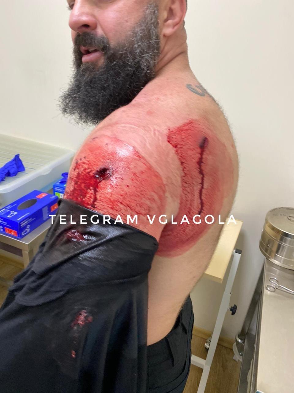 Стрілянина у Мукачеві: поранено помічника скандального екснардепа та його охоронця (ВІДЕО, ФОТО)