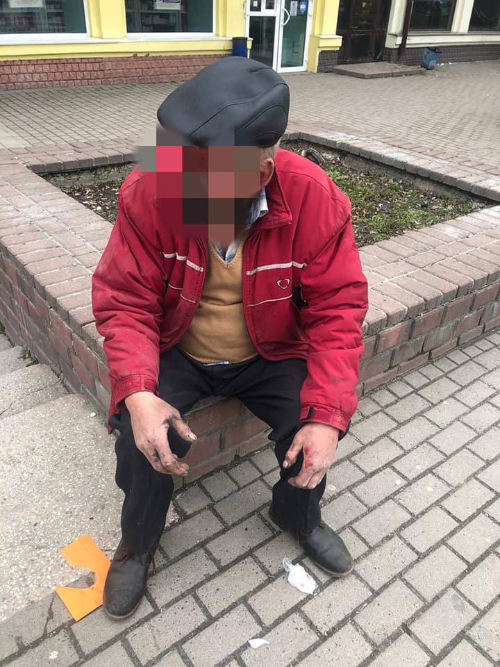 Муніципальні інспектори допомогли п’яному чоловікові, який упав і розбив голову (ФОТО)