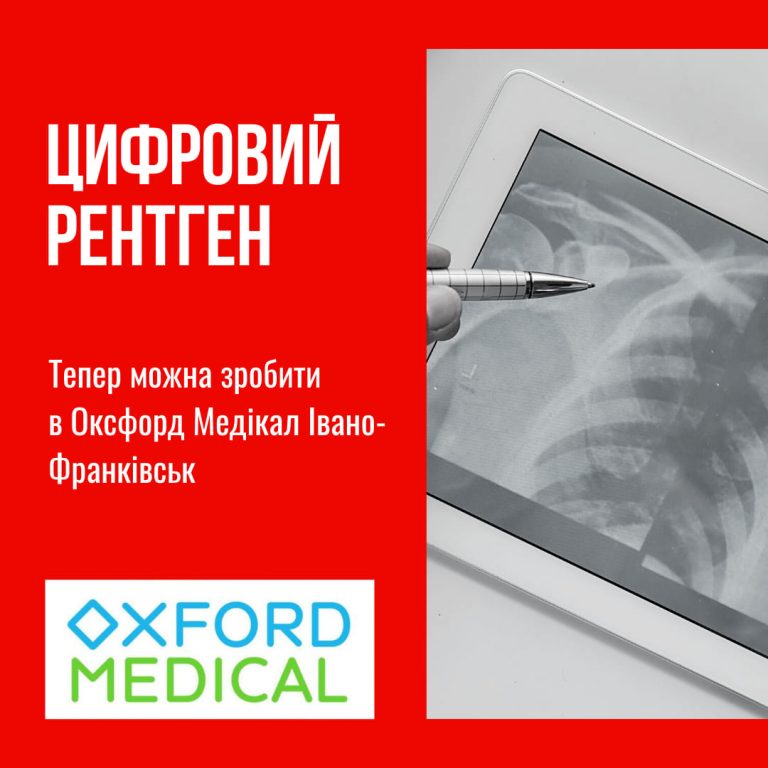 Безпечний та інформативний рентген – апарат останнього покоління в Оксфорд Медікал!