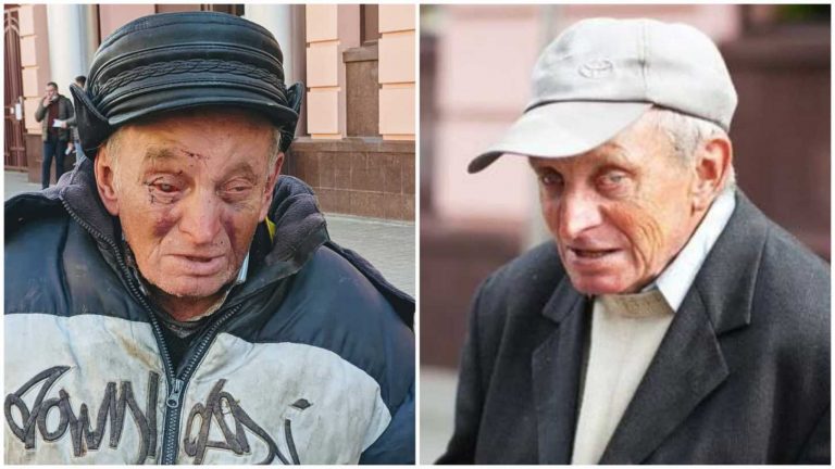 “Пане, дайте пару копійок”: Відомого франківського жебрака зі “стометрівки” знову побили (ФОТО)