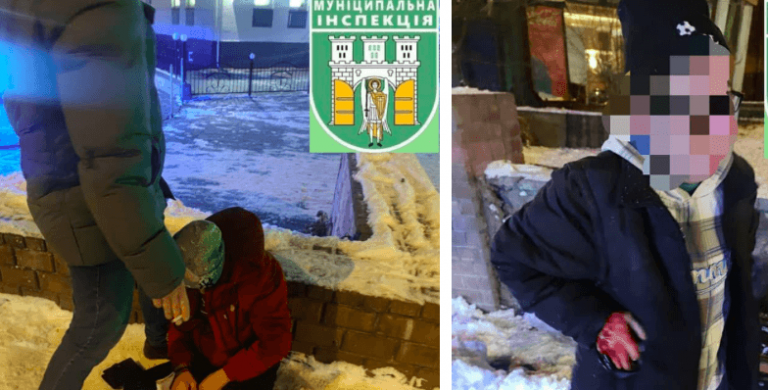 На Привокзальній площі пʼяний чоловік покусав товариша по чарці (ФОТО)