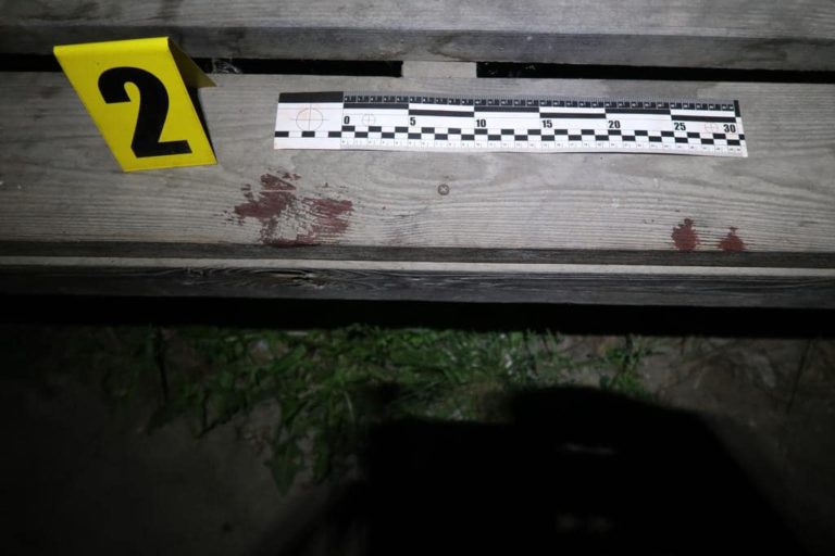 На Рогатинщині поліціянти затримали чоловіка, який побив незнайомця: останній в тяжкому стані (ФОТО)