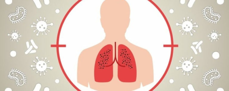 Як пацієнтам з туберкульозом отримати безоплатно медичну допомогу на Франківщині: роз’яснення НСЗУ