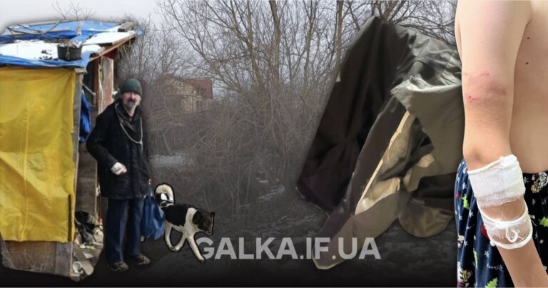 На дамбі Бистриці у Франківську собаки покусали 12-річного хлопчика: власник тварин заперечує причетність (ФОТО)