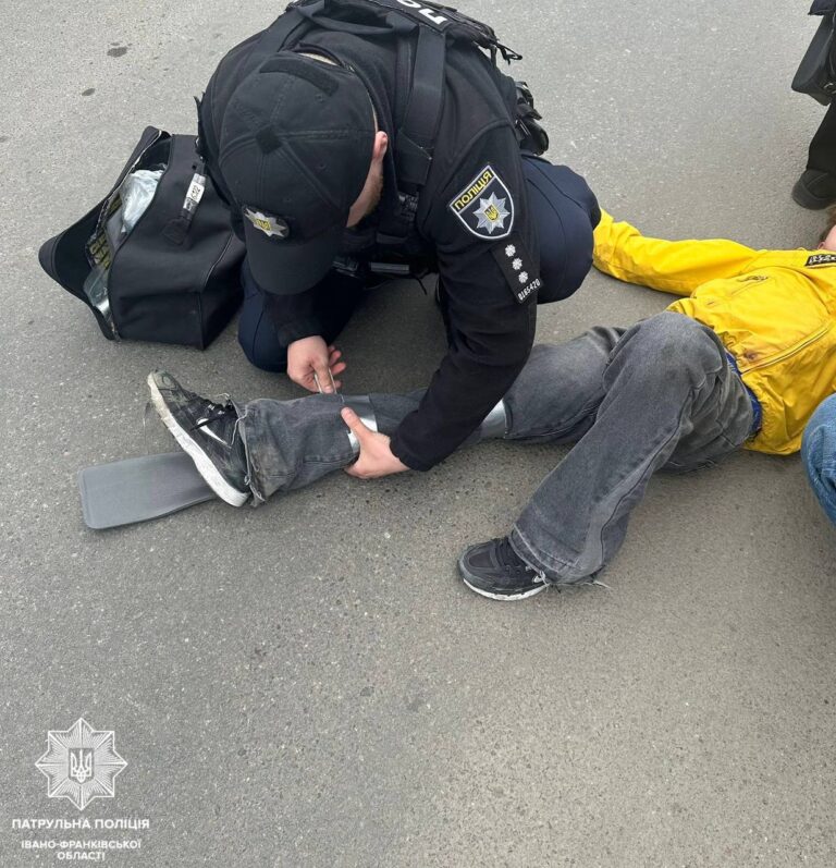 У Франківську підліток упав з самоката та травмувався: йому допомогли поліціянти (ФОТО)