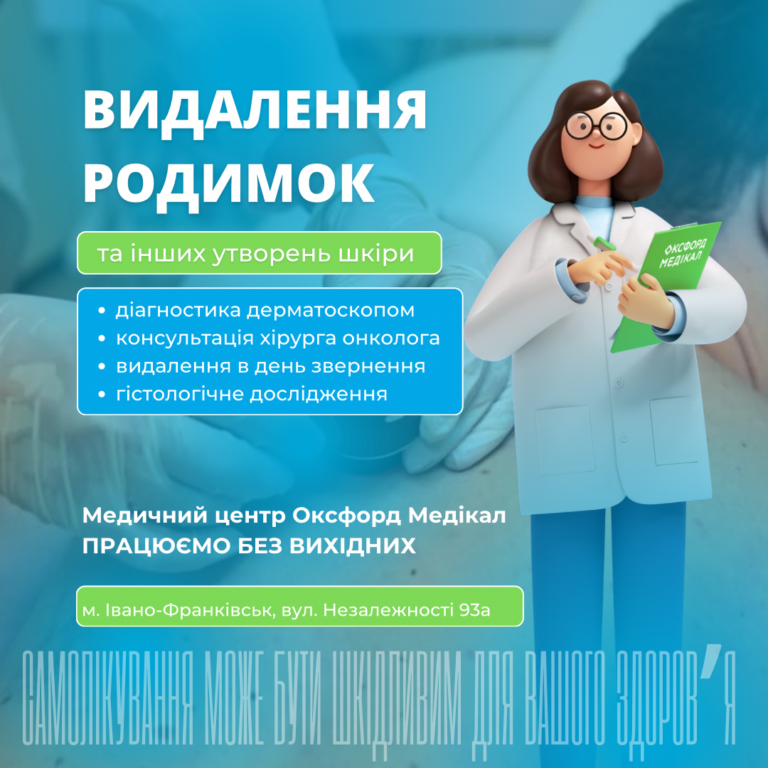 Чи варто видаляти дивну родимку або що таке симптом «гидкого каченяти»?