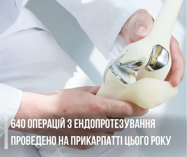 Від початку року на Прикарпатті провели 360 безоплатних операцій з ендопротезування